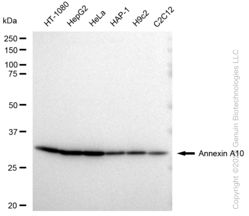 ANXA10 Rabbit Monoclonal Antibody [Clone ID: 23GB3215]