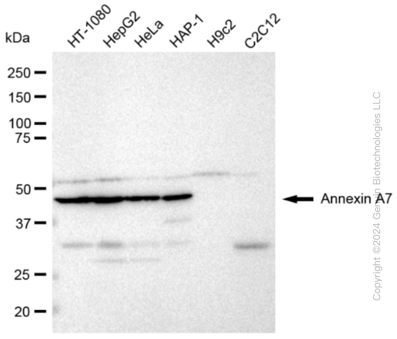 ANXA7 Rabbit Monoclonal Antibody [Clone ID: 23GB1235]