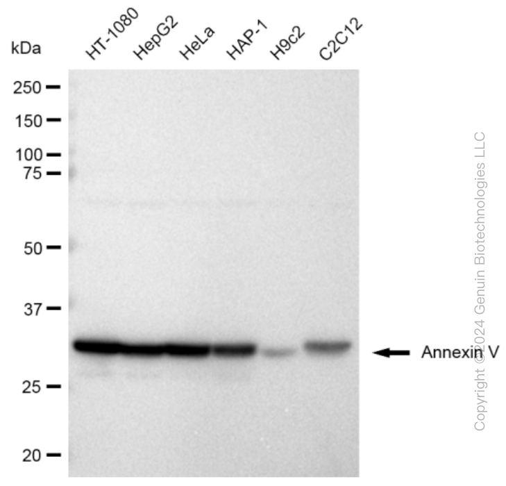 Western blotting analysis using anti-Annexin V antibody . Total cell lysates (30 μg) from various cell lines were loaded and separated by SDS-PAGE. The blot was incubated with anti-Annexin V antibody and HRP-conjugated goat anti rabbit secondary antibody respectively. Image was developed using anti-FeQ™ ECL Substrate Kit .