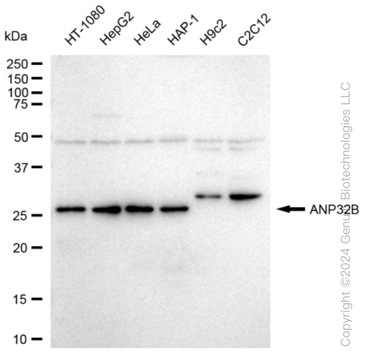 ANP32B Rabbit Monoclonal Antibody [Clone ID: 23GB3650]