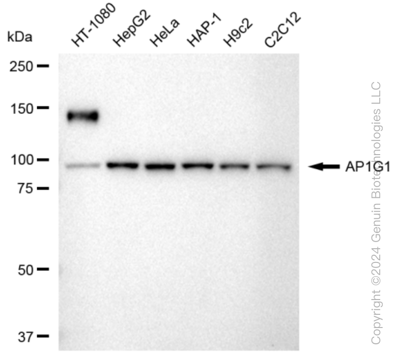 AP1G1 Rabbit Monoclonal Antibody [Clone ID: 23GB3655]