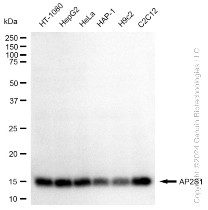 Western blotting analysis using anti-AP2S1 antibody . Total cell lysates (30 μg) from various cell lines were loaded and separated by SDS-PAGE. The blot was incubated with anti-AP2S1 antibody and HRP-conjugated goat anti-rabbit secondary antibody respectively. Image was developed using anti-FeQ™ ECL Substrate Kit . AP2S1, adaptor related protein complex 2 subunit sigma 1.