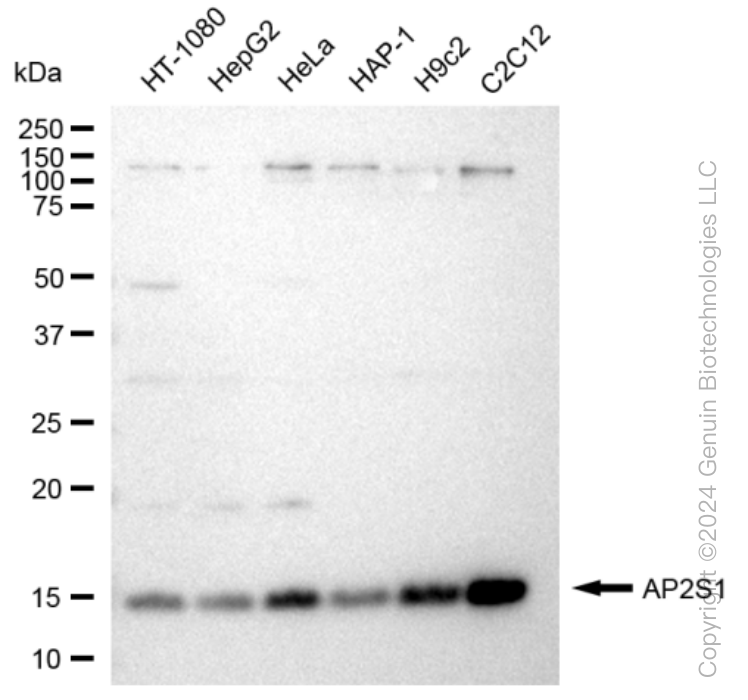 AP2S1 Rabbit Monoclonal Antibody [Clone ID: 23GB3660]
