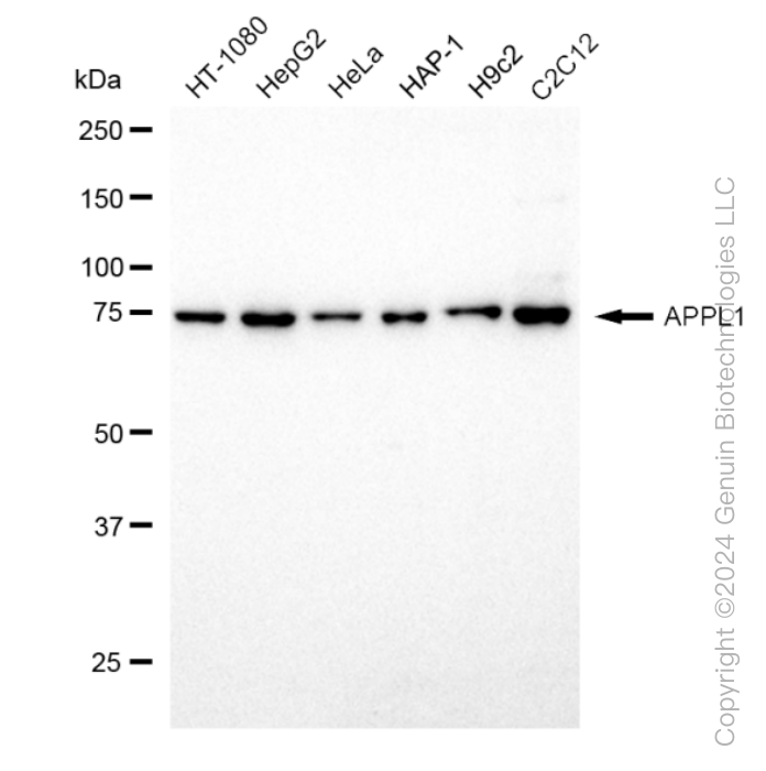 Western blotting analysis using anti-APPL1 antibody . Total cell lysates (30 μg) from various cell lines were loaded and separated by SDS-PAGE. The blot was incubated with anti-APPL1 antibody and HRP-conjugated goat anti-rabbit secondary antibody respectively. Image was developed using anti-FeQ™ ECL Substrate Kit . APPL1, adaptor protein, phosphotyrosine interacting with PH domain and leucine zipper 1.