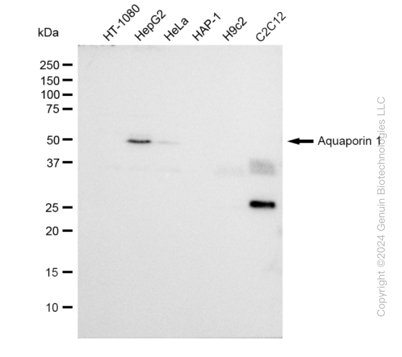 AQP1 Rabbit Monoclonal Antibody [Clone ID: 23GB1850]