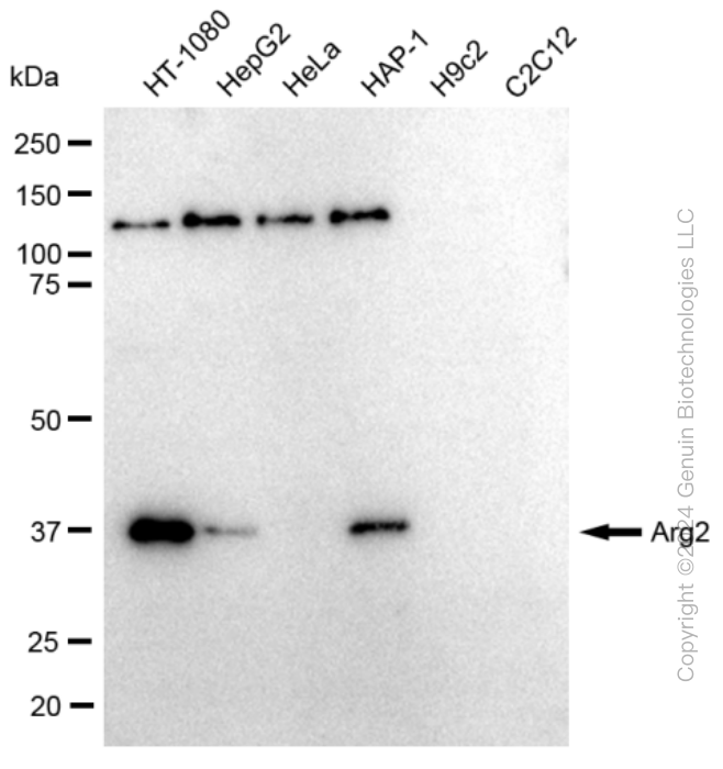 ARG2 Rabbit Monoclonal Antibody [Clone ID: 23GB655]