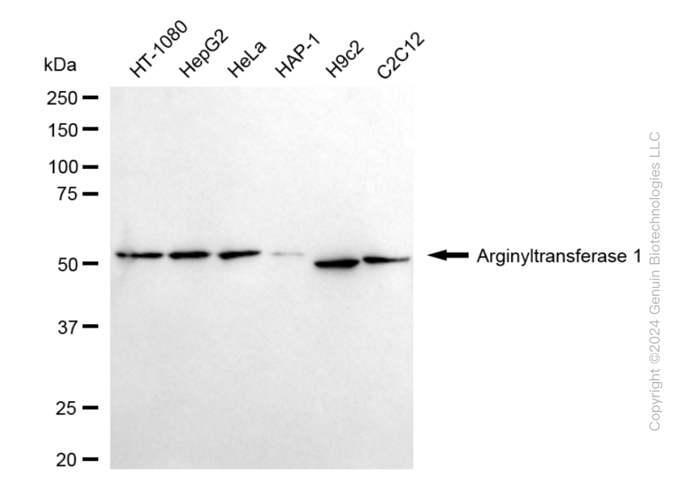 ATE1 Rabbit Monoclonal Antibody [Clone ID: 24GB4720]