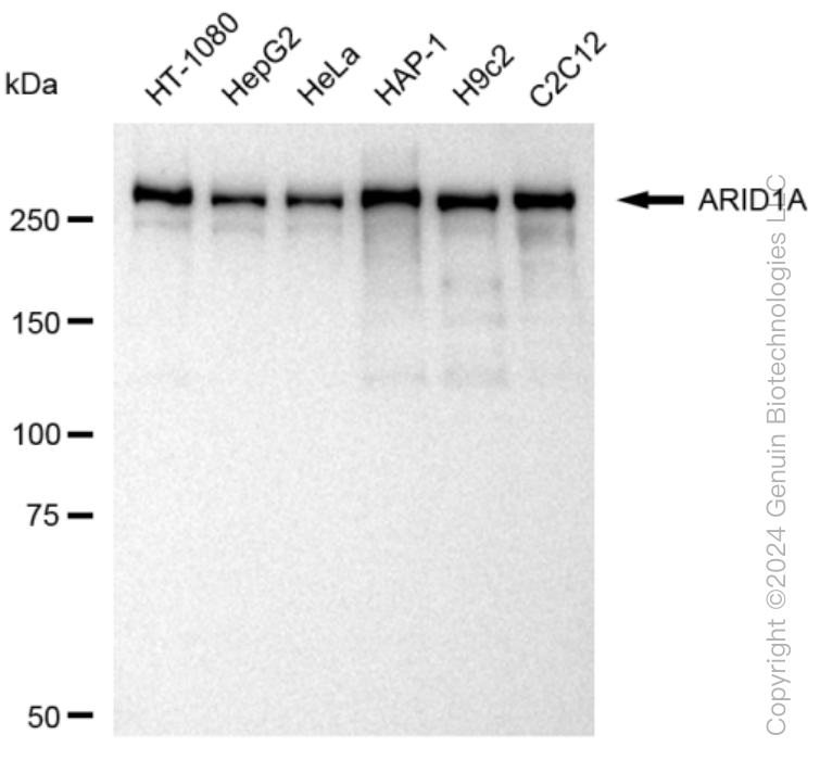 ARID1A Rabbit Monoclonal Antibody [Clone ID: 23GB3230]