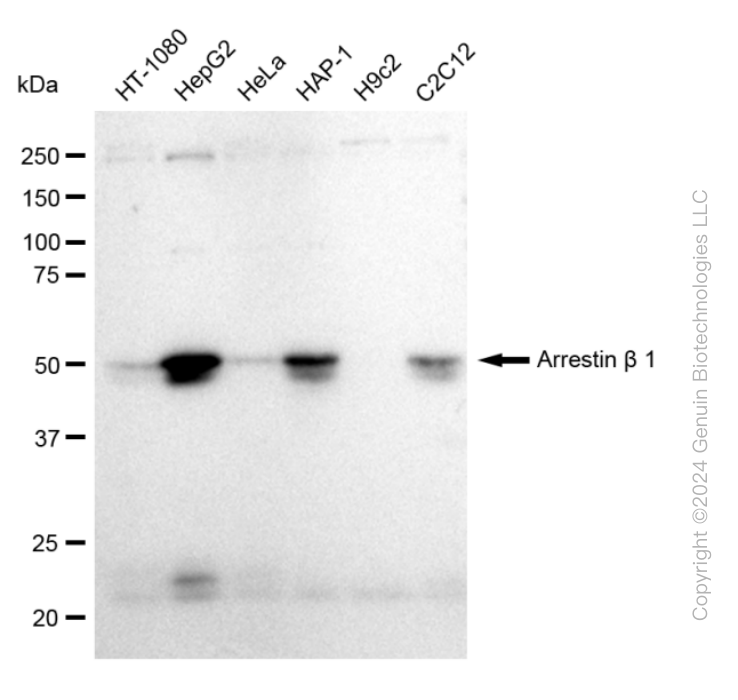 ARRB1 Rabbit Monoclonal Antibody [Clone ID: 23GB1755]