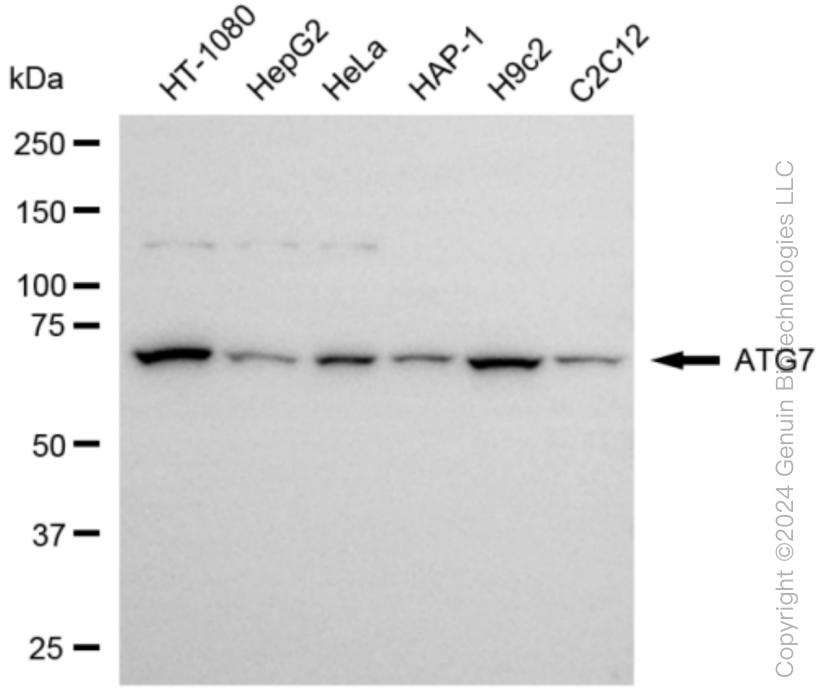 Western blotting analysis using anti-ATG7 antibody . Total cell lysates (30 μg) from various cell lines were loaded and separated by SDS-PAGE. The blot was incubated with anti-ATG7 antibody and HRP-conjugated goat anti-rabbit secondary antibody respectively. Image was developed using anti-NaQ™ ECL Substrate Kit .