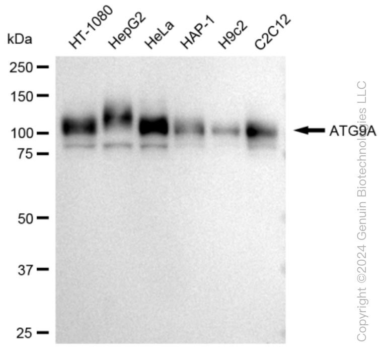 Western blotting analysis using anti-ATG9A antibody . Total cell lysates (30 μg) from various cell lines were loaded and separated by SDS-PAGE. The blot was incubated with anti-ATG9A antibody and HRP-conjugated goat anti-rabbit secondary antibody respectively. Image was developed using anti-FeQ™ ECL Substrate Kit .