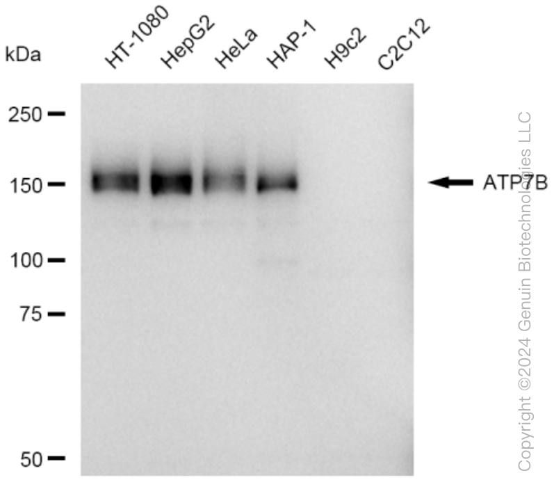 ATP7B Rabbit Monoclonal Antibody [Clone ID: 23GB3945]