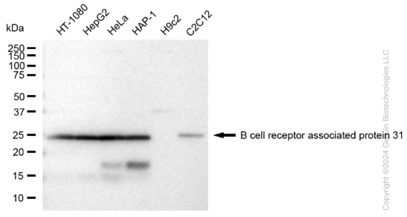 BCAP31 Rabbit Monoclonal Antibody [Clone ID: 23GB3680]