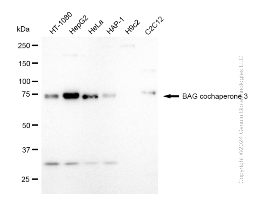 BAG3 Rabbit Monoclonal Antibody [Clone ID: 23GB1520]