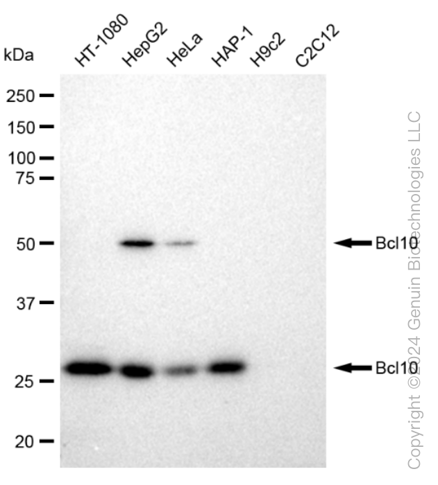 BCL10 Rabbit Monoclonal Antibody [Clone ID: 23GB1210]