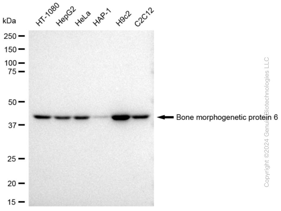 BMP6 Rabbit Monoclonal Antibody [Clone ID: 23GB3705]