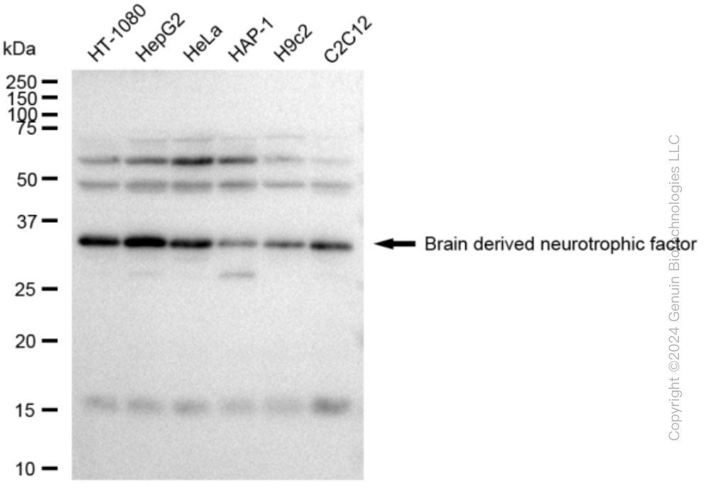 BDNF Rabbit Monoclonal Antibody [Clone ID: 23GB3005]