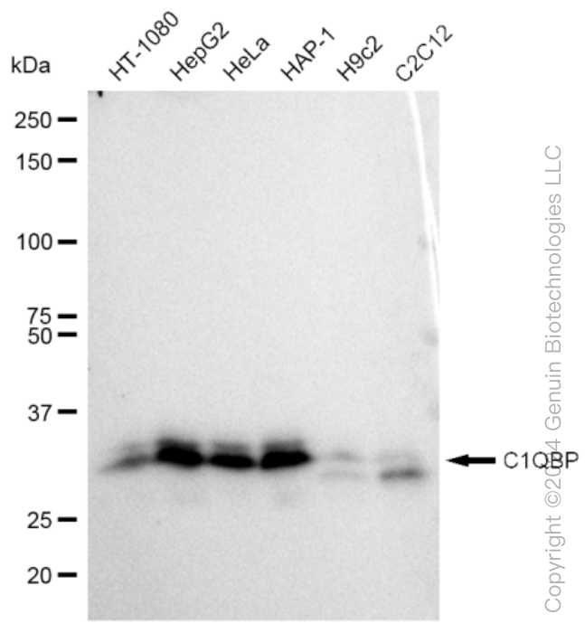 C1QBP Rabbit Monoclonal Antibody [Clone ID: 23GB690]