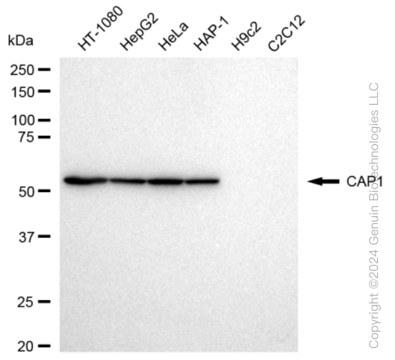 CAP1 Rabbit Monoclonal Antibody [Clone ID: 23GB3020]