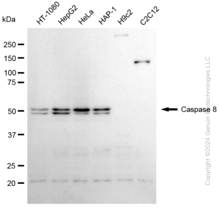 CASP8 Rabbit Monoclonal Antibody [Clone ID: 24GB4740]