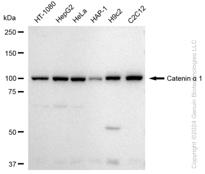 CTNNA1 Rabbit Monoclonal Antibody [Clone ID: 23GB3335]