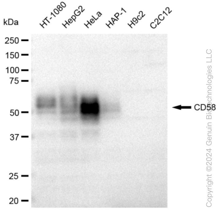 CD58 Rabbit Monoclonal Antibody [Clone ID: 23GB3050]