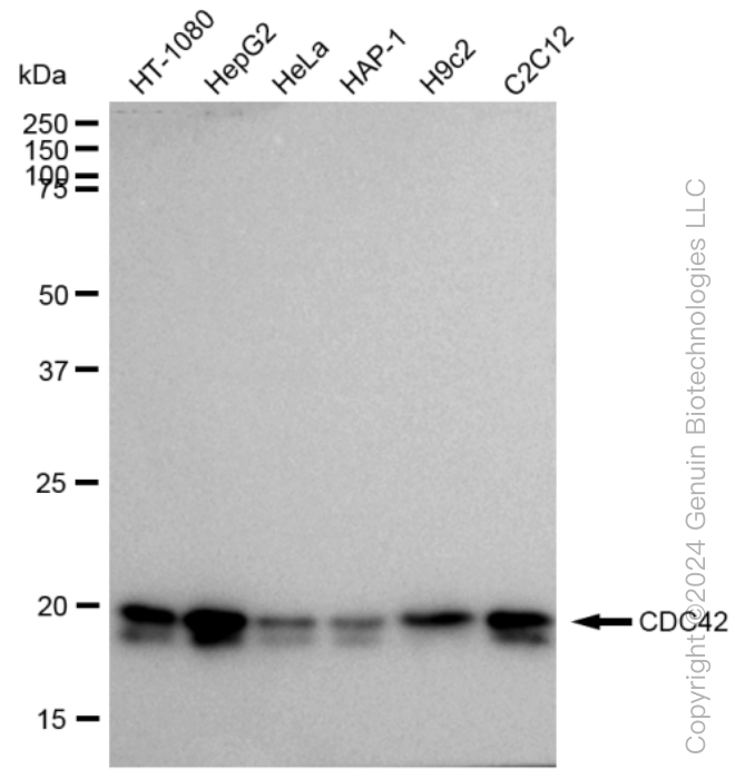 CDC42 Rabbit Monoclonal Antibody [Clone ID: 23GB1025]