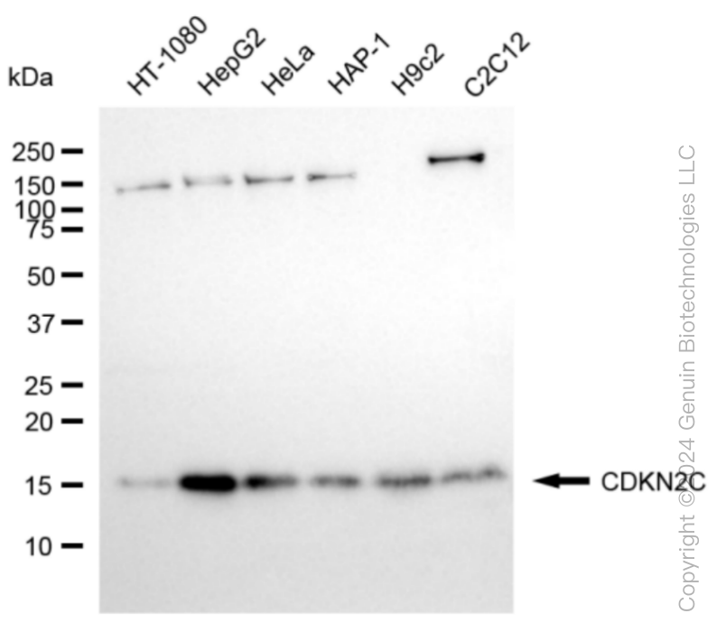 CDKN2C Rabbit Monoclonal Antibody [Clone ID: 24GB5945]