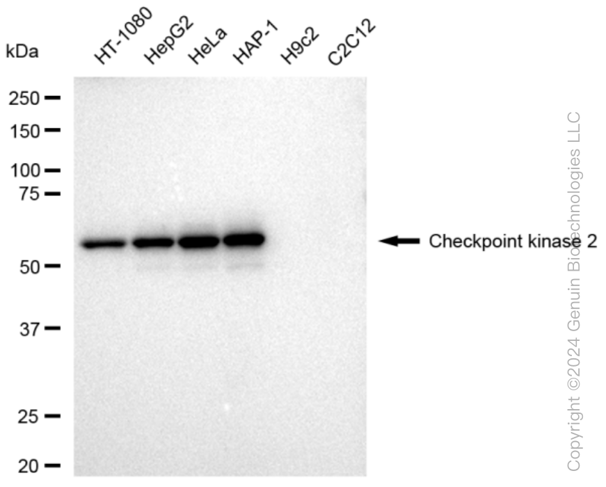 CHEK2 Rabbit Monoclonal Antibody [Clone ID: 23GB3460]