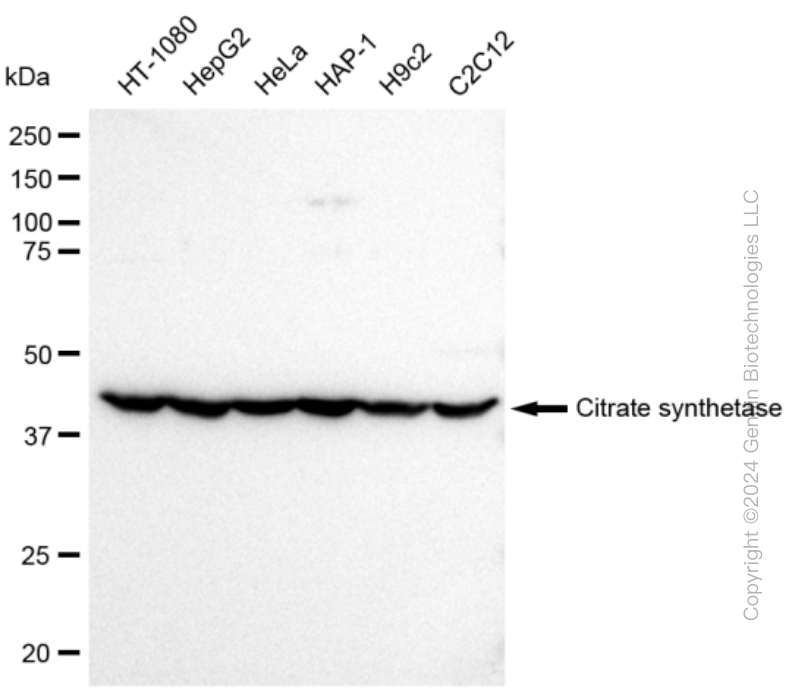 CS Rabbit Monoclonal Antibody [Clone ID: 23GB780]