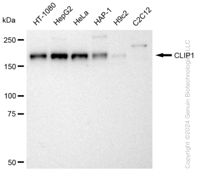 CLIP1 Rabbit Monoclonal Antibody [Clone ID: 23GB3080]