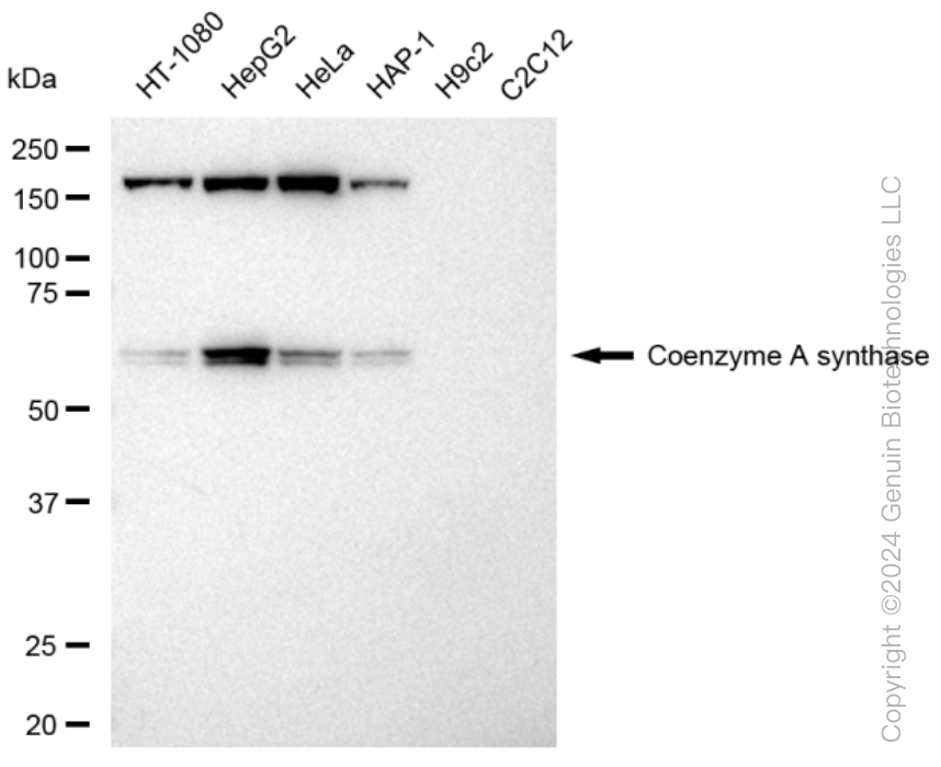 COASY Rabbit Monoclonal Antibody [Clone ID: 23GB3095]