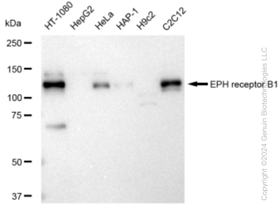 Western blotting analysis using anti-EPH receptor B1 antibody . Total cell lysates (30 μg) from various cell lines were loaded and separated by SDS-PAGE. The blot was incubated with anti-EPH receptor B1 antibody and HRP-conjugated goat anti-rabbit secondary antibody respectively. Image was developed using anti-FeQ™ ECL Substrate Kit .