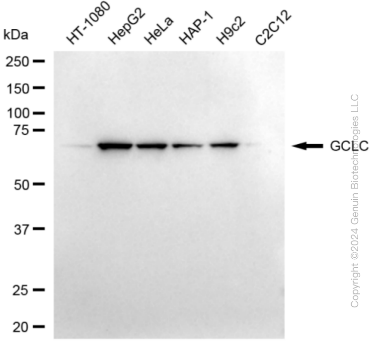 GCLC Rabbit Monoclonal Antibody [Clone ID: 24GB4860]