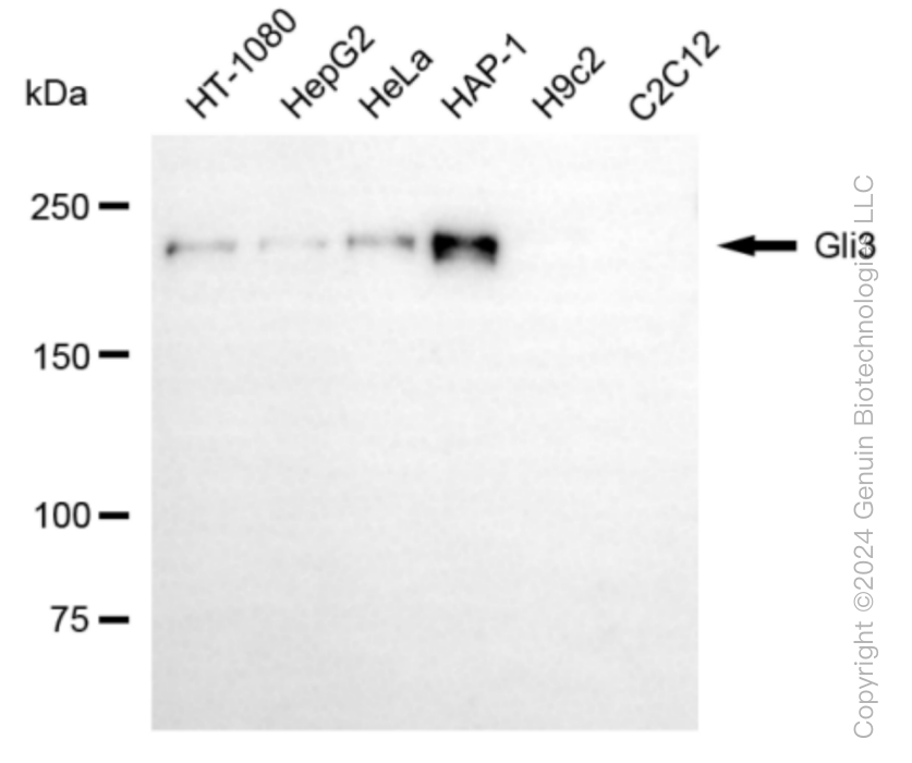 GLI3 Rabbit Monoclonal Antibody [Clone ID: 24GB6105]