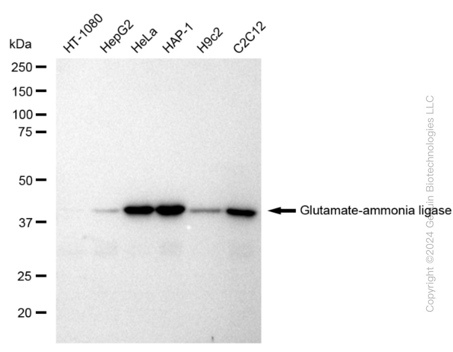 GLUL Rabbit Monoclonal Antibody [Clone ID: 23GB1345]