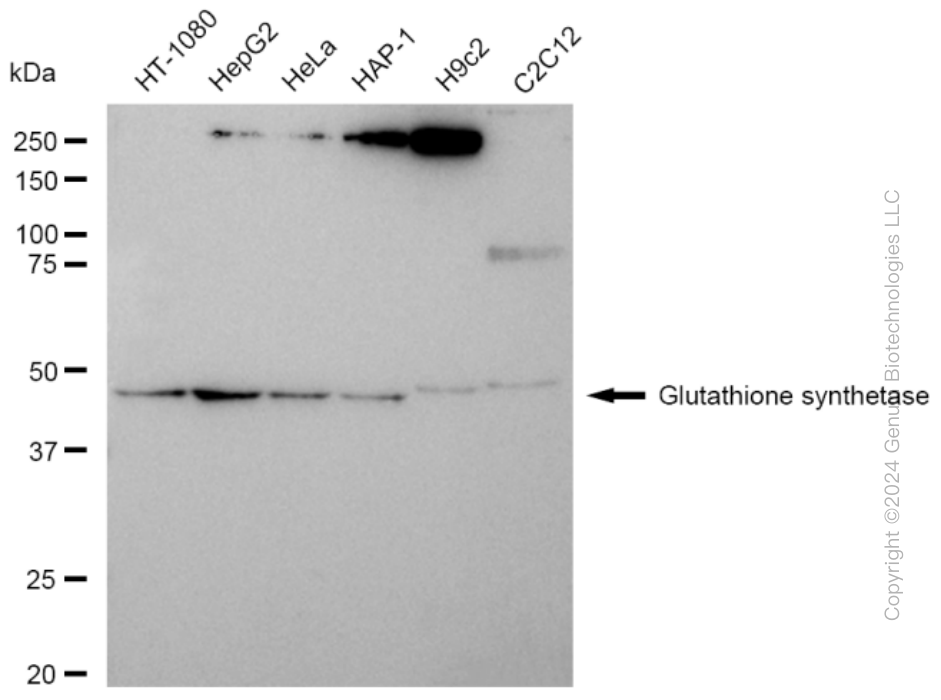 GSS Rabbit Monoclonal Antibody [Clone ID: 23GB4385]