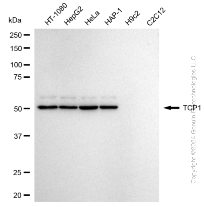 TCP1 Rabbit Monoclonal Antibody [Clone ID: 24GB4245]