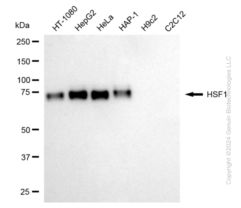 HSF1 Rabbit Monoclonal Antibody [Clone ID: 24GB5405]