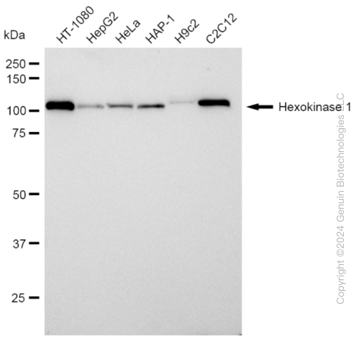 HK1 Rabbit Monoclonal Antibody [Clone ID: 23GB870]