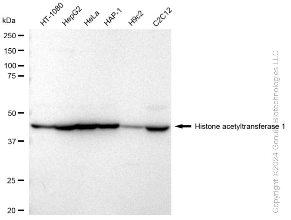 HAT1 Rabbit Monoclonal Antibody [Clone ID: 23GB2090]