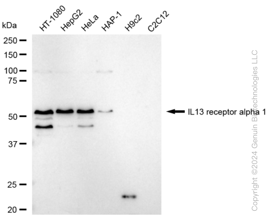 IL13RA1 Rabbit Monoclonal Antibody [Clone ID: 23GB6655]