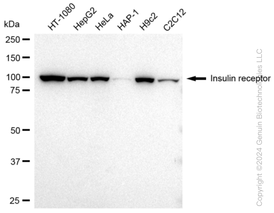 INSR Rabbit Monoclonal Antibody [Clone ID: 23GB2050]