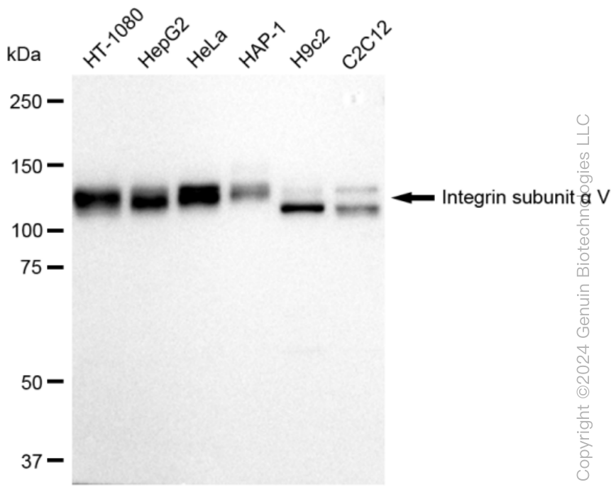 ITGAV Rabbit Monoclonal Antibody [Clone ID: 23GB2240]