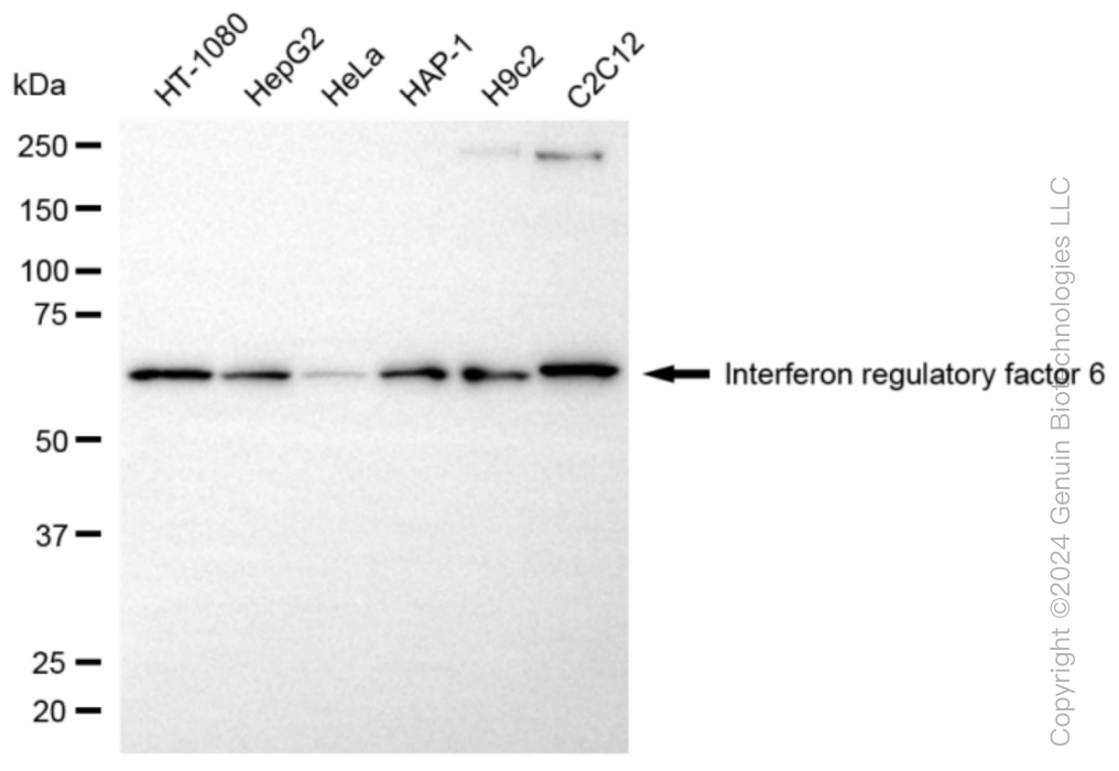 IRF6 Rabbit Monoclonal Antibody [Clone ID: 24GB6015]