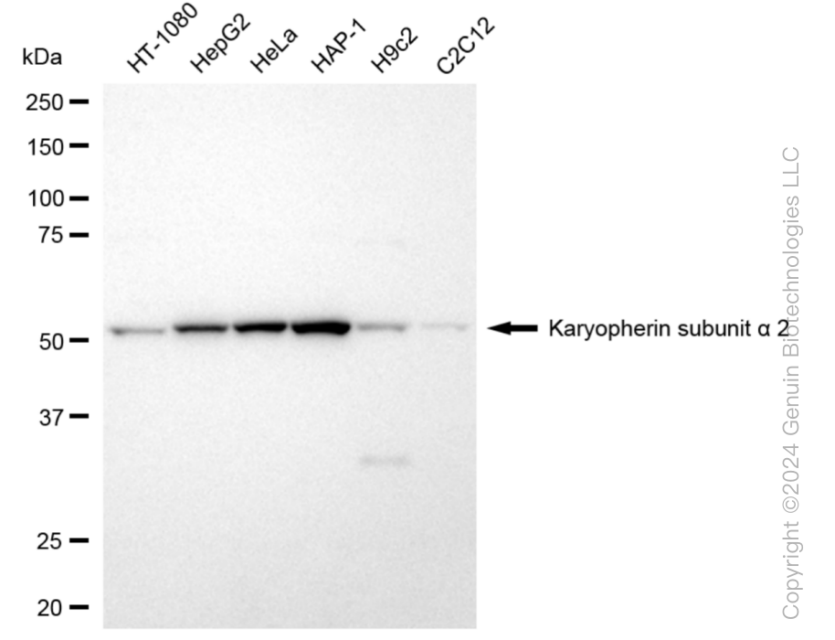 KPNA2 Rabbit Monoclonal Antibody [Clone ID: 24GB5955]