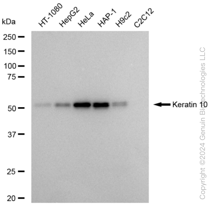 KRT10 Rabbit Monoclonal Antibody [Clone ID: 23GB6105] | TA424912 ...