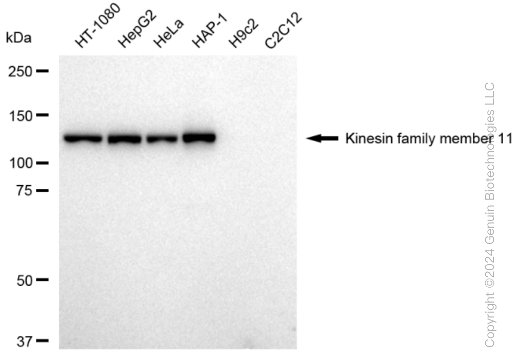 KIF11 Rabbit Monoclonal Antibody [Clone ID: 23GB2025]