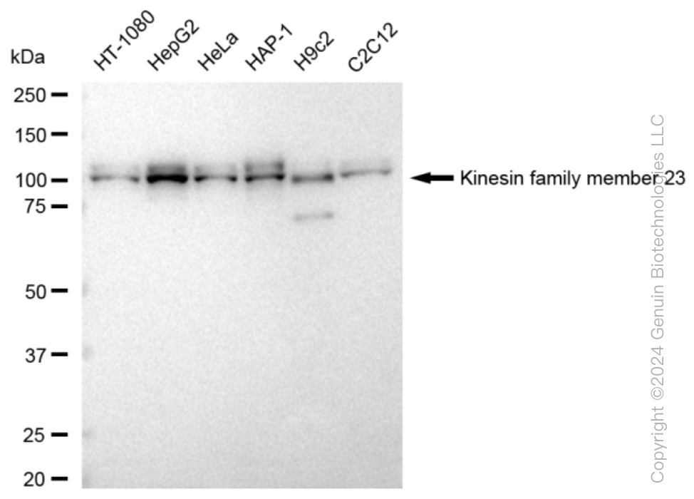 KIF23 Rabbit Monoclonal Antibody [Clone ID: 23GB4035]