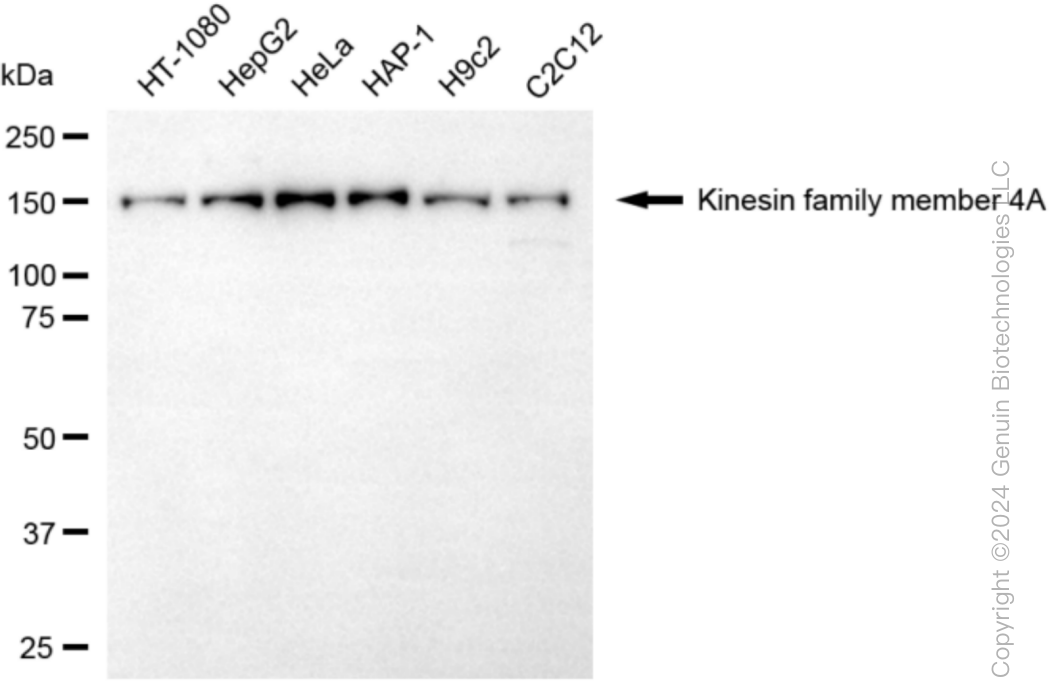 KIF4A Rabbit Monoclonal Antibody [Clone ID: 24GB6025]
